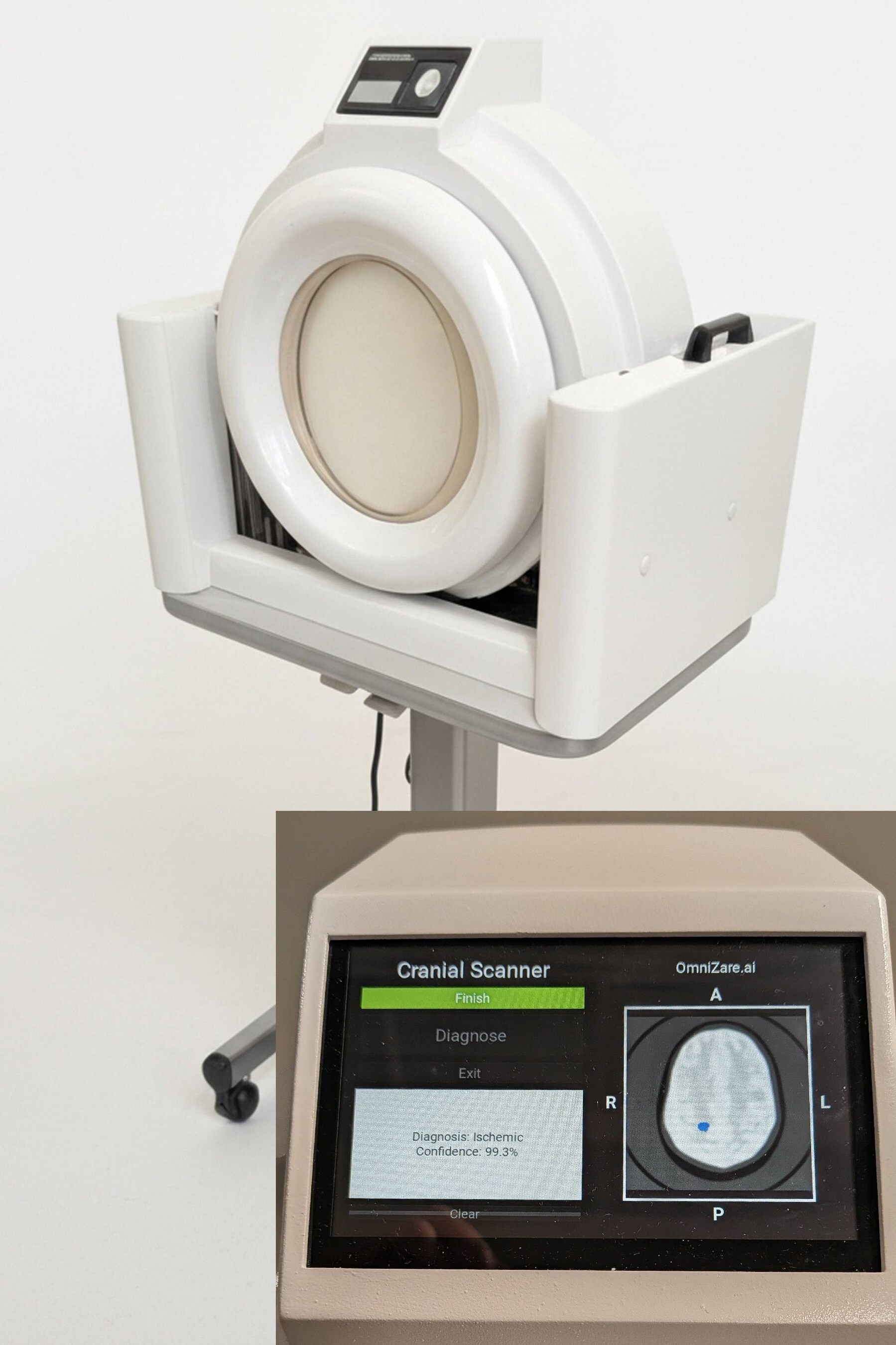 OmniZare's cranial scanner provides rapid brain imaging for emergency radiology and monitoring
